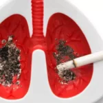 ¿Cómo prevenir la enfermedad pulmonar obstructiva crónica?