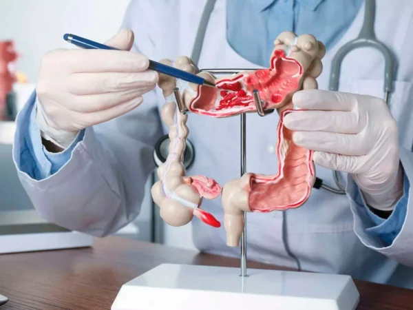 ¿Qué enfermedades se confunden con el síndrome de colon irritable?