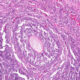 Histología de ovario