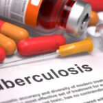 Tratamiento de la tuberculosis resistente a los medicamentos