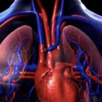 Hipertensión pulmonar