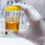 Determinación urinaria de electrolitos