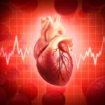 Arritmias en pacientes con infarto agudo al miocardio con elevación del segmento ST