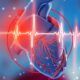Defectos mecánicos como complicación de infarto