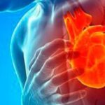 Disfunción miocárdica post infarto