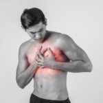 Pericarditis inflamatoria aguda
