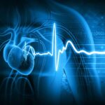 Infarto del ventrículo derecho