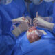 Tratamiento de la regurgitación mitral secundaria