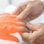 ¿Qué son las neuropatías periféricas?