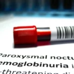 Hemoglobinuria paroxística nocturna