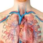 Obstrucción de la vena cava superior