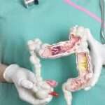 Causas de sangrado del tubo digestivo bajo