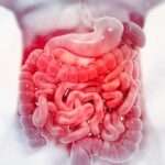 ¿Que hacer ante la sospecha de sangrado del intestino delgado?