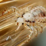 Tratamiento de la pediculosis