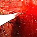 Hemorragia gastrointestinal como complicación de la úlcera péptica