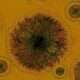 Hepatitis E
