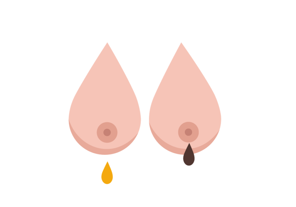 Flujo mamario