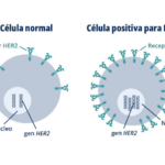 Terapia dirigida a HER2 en el cáncer de mama