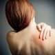 Fibromialgia