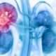 Lesión renal aguda