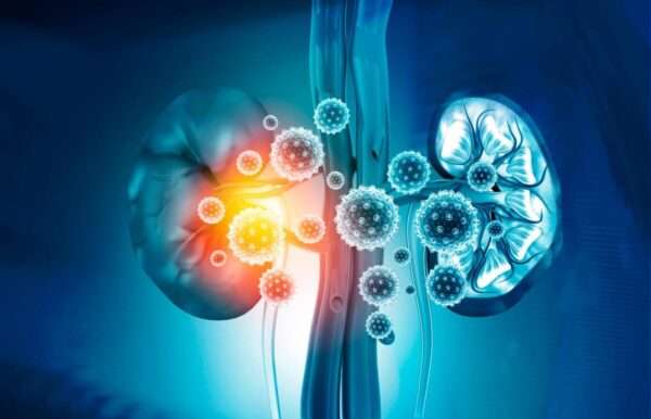 COVID_19 y el riñón