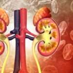 Enfermedad renal crónica