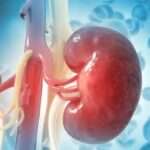 Complicaciones hematológicas de la insuficiencia renal crónica