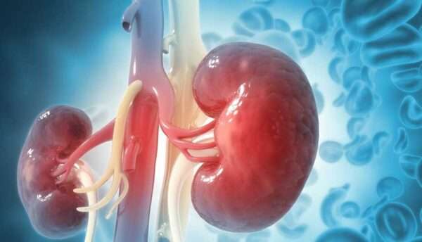 Complicaciones hematológicas de la insuficiencia renal crónica
