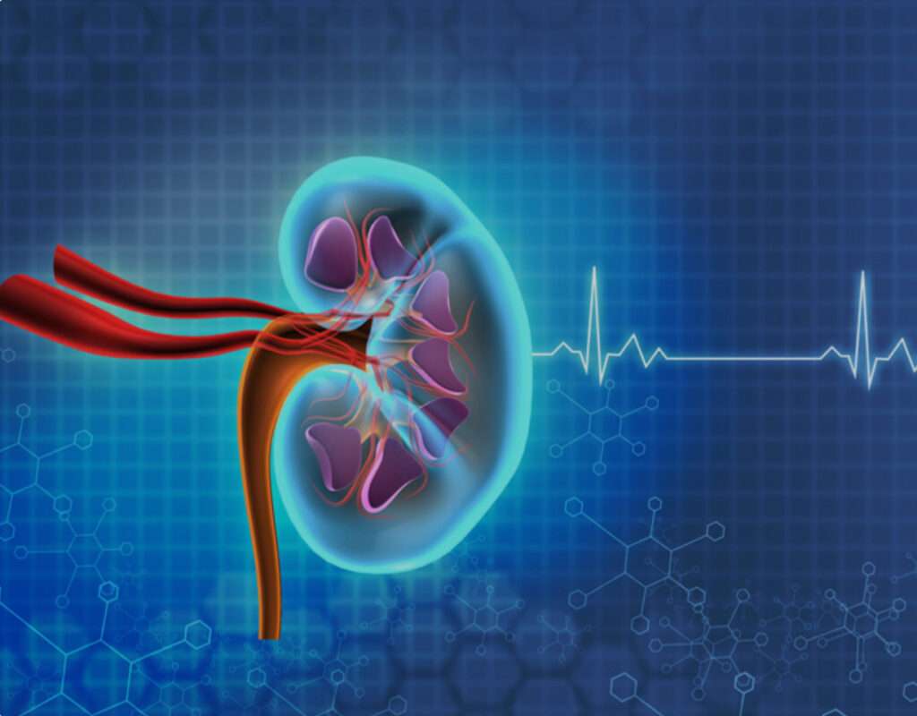 Hiperpotasemia en pacientes con enfermedad renal crónica
