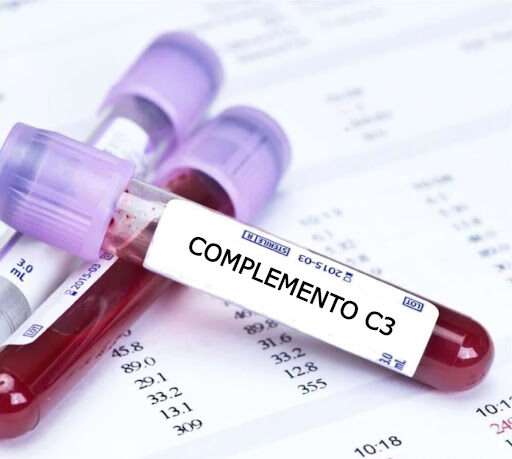Glomerulopatías C3