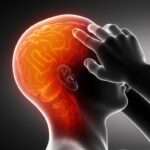 Cefalea debido a causas neurológicas