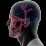 Neuralgia del trigémino