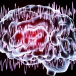 Tipos de convulsiones epilépticas