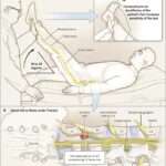 ¿Cuál es la prueba de Lasègue?