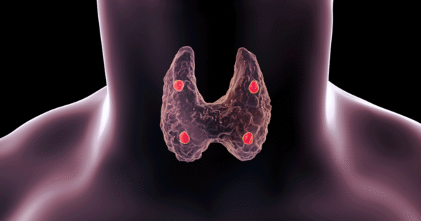 Hipoparatiroidismo y seudohipoparatiroidismo