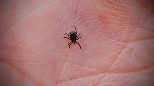 Fiebres hemorrágicas