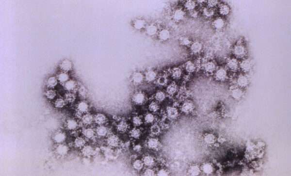 Las infecciones por echovirus