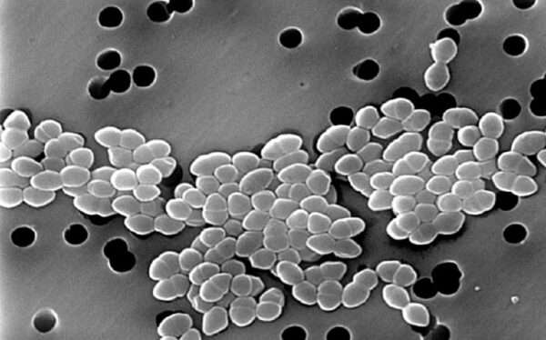 Infecciones por enterococos