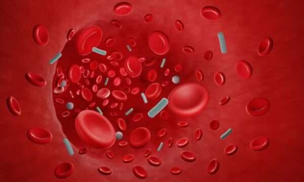 Bacteremia y sepsis por bacterias Gram-negativas