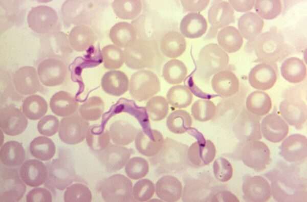 Trypanosomiasis americana (Enfermedad de Chagas)