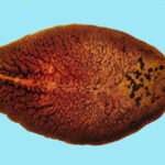 Fasciolasis