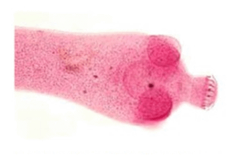 Infecciones de céstodos no invasivas
