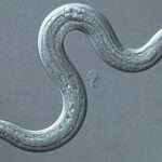Angiostrongiliasis