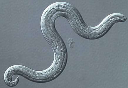 Angiostrongiliasis