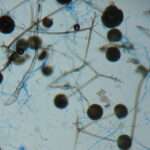 Mucormicosis
