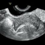 Desarrollo histórico de distintas técnicas ecocardiográficas