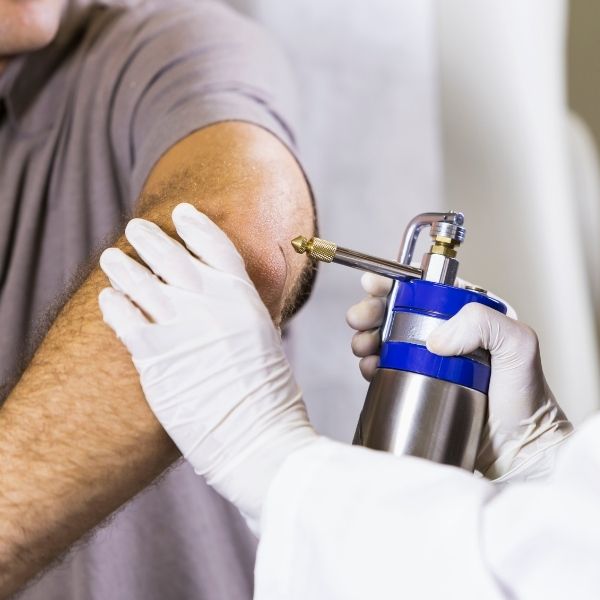 Pistola de aplicación de nitrógeno líquido para criocirugía Pistola de aplicación de nitrógeno líquido para criocirugía