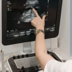 Interacción de los Ultrasonidos con los Tejidos y su Aplicación en Ecografía