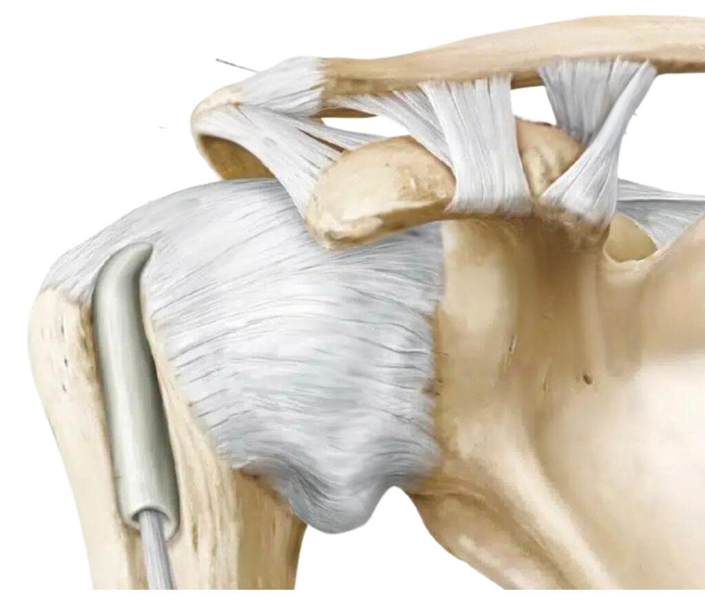 Articulaciones de la cintura pectoral