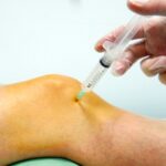 Artrocentésis evacuadora de rodilla